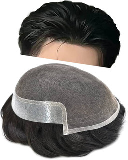 عوارض پروتز مو