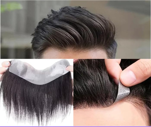 پروتز جلوسر مردانه