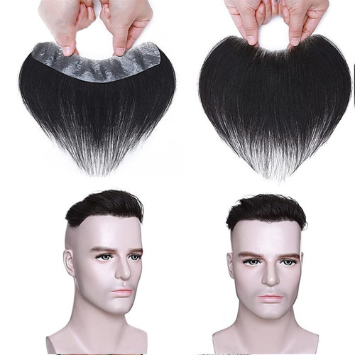 پروتز شقیقه طبیعی مردانه