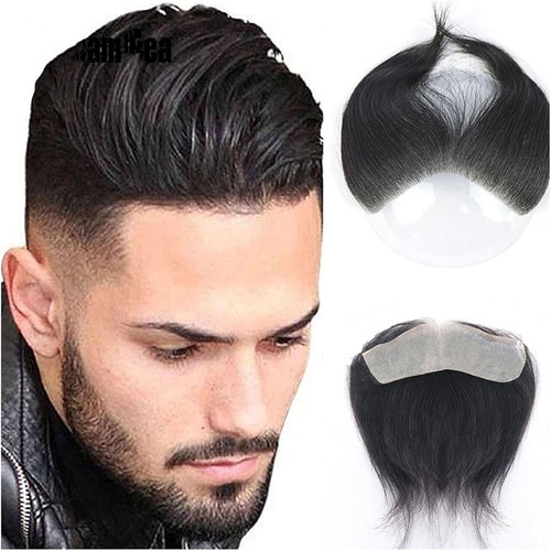 پروتز جلو سر مردانه وارداتی