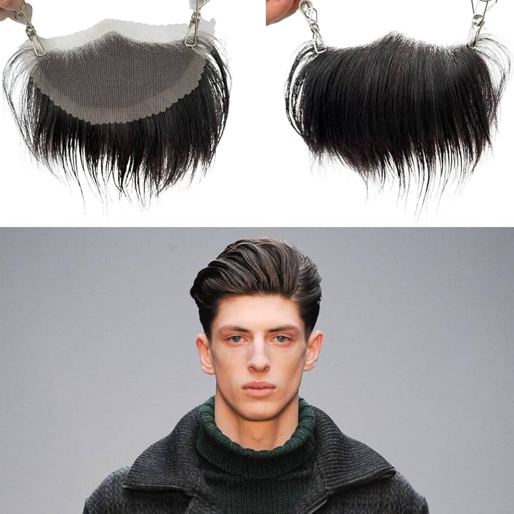 پروتز مو شقیقه