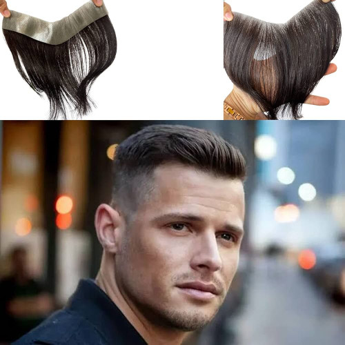 پروتز جلوسر مردانه