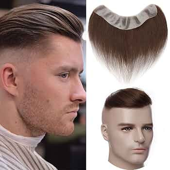 پروتز شقیقه مردانه