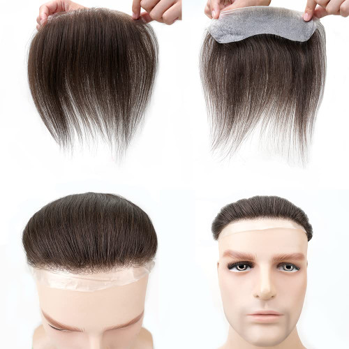 پروتز شقیقه مردانه